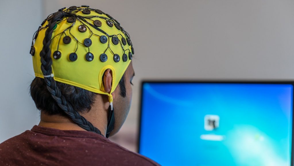 cinematische-renderings kinematische Renderings Gehirn-CTA-Scans